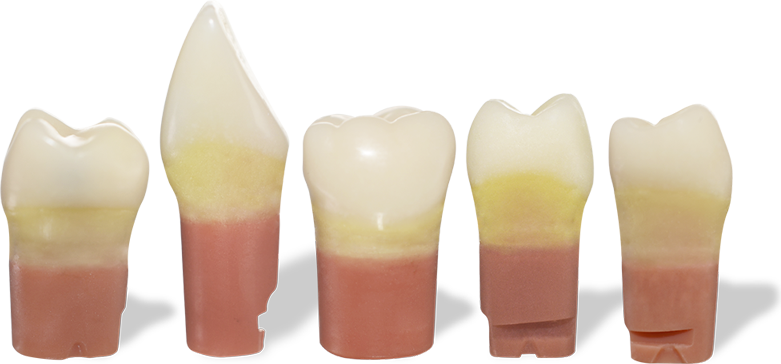 RTX Carious teeth