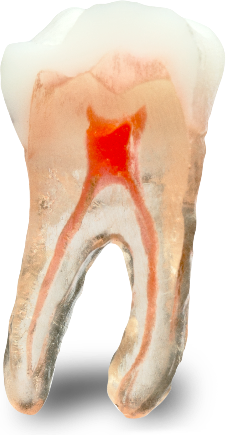 Lifelike Coronal Hardness